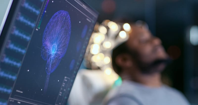 Man sleeping during his brain scan